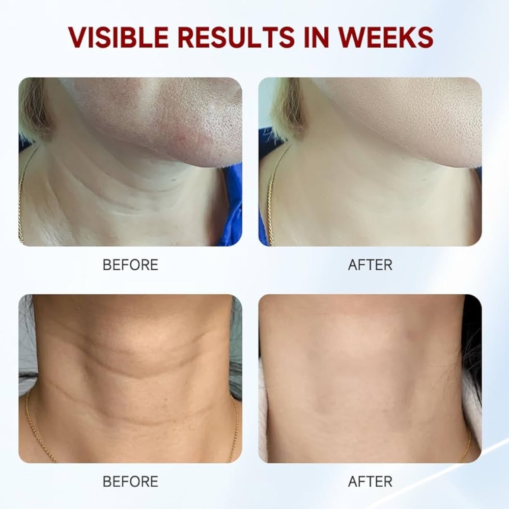 Skin Care Treatment for Visible Results